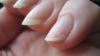 Why does gel polish on nails crack?