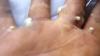 Co zrobić, jeśli palec złamie się w pobliżu paznokcia?